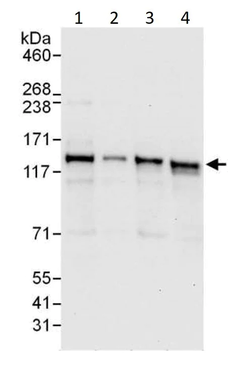 Western blot - Anti-DIAPH2/DIA antibody (AB12319)