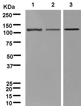 Western blot - Anti-DIAPH2/DIA antibody [EPR13158] (AB181165)