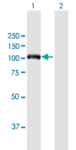 Western blot - Anti-DIAPH3 antibody (AB172701), expandable thumbnail