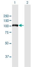 Western blot - Anti-DIAPH3 antibody (AB172701)