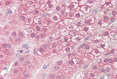 Immunohistochemistry (Formalin/PFA-fixed paraffin-embedded sections) - Anti-DIAPH3 antibody (AB189373)