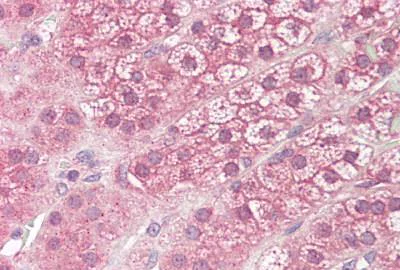 Immunohistochemistry (Formalin/PFA-fixed paraffin-embedded sections) - Anti-DIAPH3 antibody (AB189373)