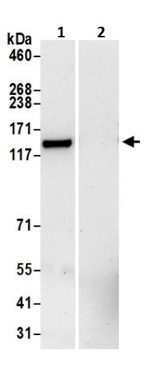 Immunoprecipitation - Anti-DIAPH3 antibody (AB245659)