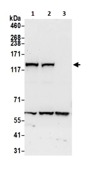 Western blot - Anti-DIAPH3 antibody (AB245659)