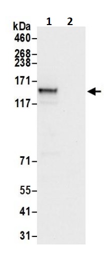 Immunoprecipitation - Anti-DIAPH3 antibody (AB245660)