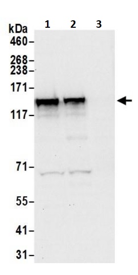 Western blot - Anti-DIAPH3 antibody (AB245660)