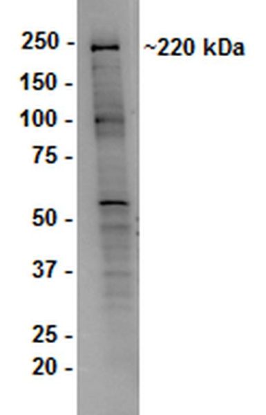 Western blot - Anti-Dicer antibody [13D6] - ChIP Grade (AB14601), expandable thumbnail