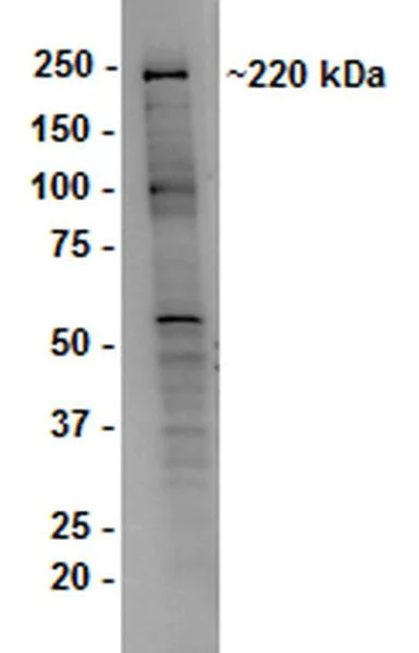 Western blot - Anti-Dicer antibody [13D6] - ChIP Grade (AB14601)