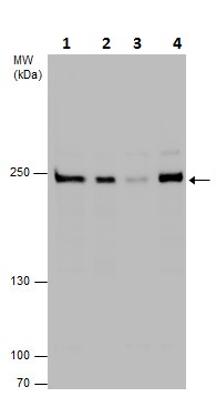 Western blot - Anti-Dicer antibody (AB227518)