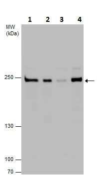 Western blot - Anti-Dicer antibody (AB227518)
