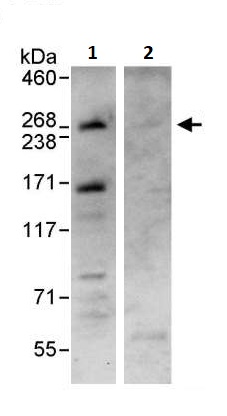 Immunoprecipitation - Anti-Dicer antibody (AB264250)