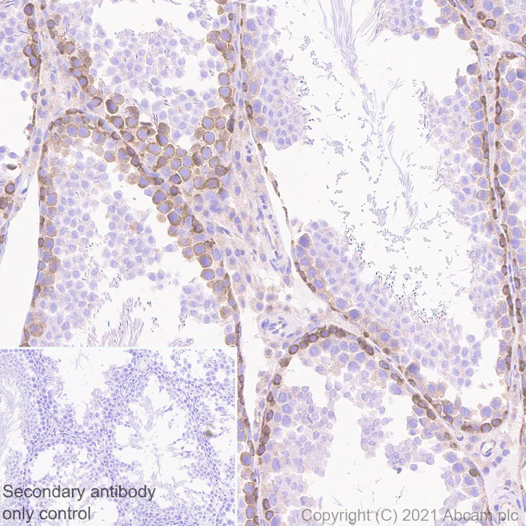 Immunohistochemistry (Formalin/PFA-fixed paraffin-embedded sections) - Anti-Dicer antibody [EPR24104-105] (AB259327)