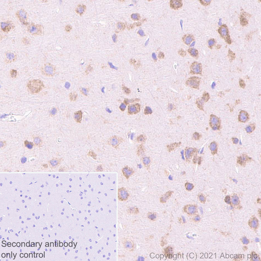 Immunohistochemistry (Formalin/PFA-fixed paraffin-embedded sections) - Anti-Dicer antibody [EPR24104-105] - BSA and Azide free (AB280957), expandable thumbnail
