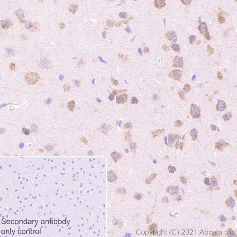 Immunohistochemistry (Formalin/PFA-fixed paraffin-embedded sections) - Anti-Dicer antibody [EPR24104-105] - BSA and Azide free (AB280957)