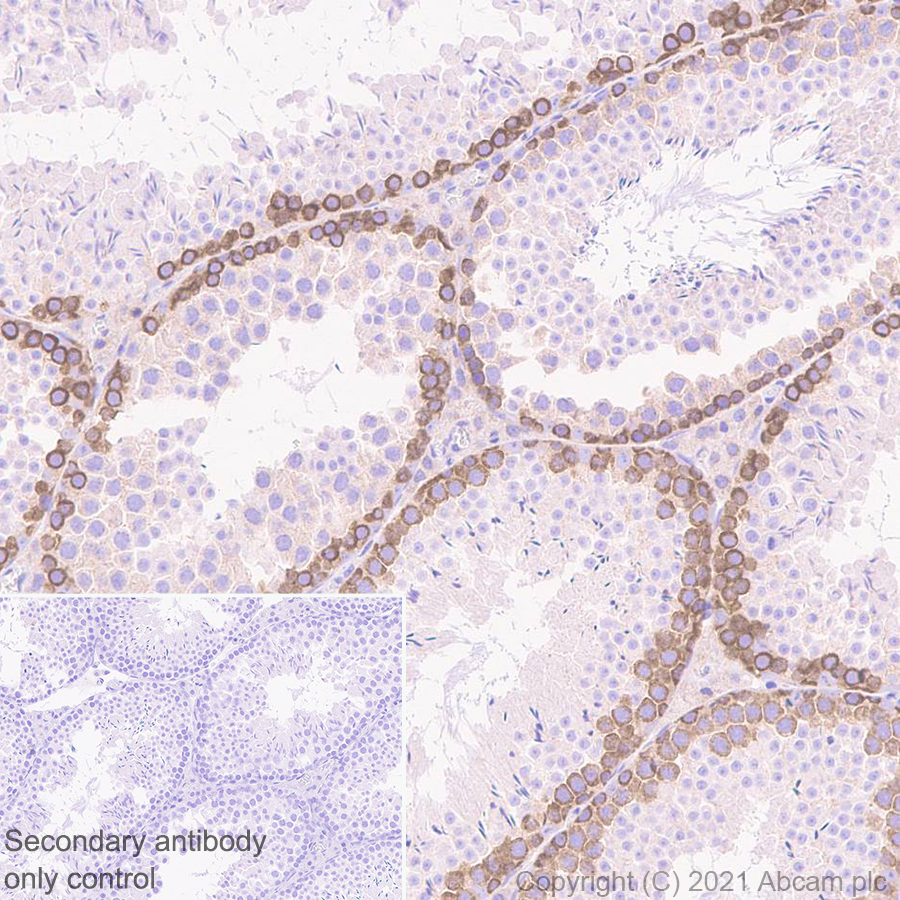 Immunohistochemistry (Formalin/PFA-fixed paraffin-embedded sections) - Anti-Dicer antibody [EPR24104-105] - BSA and Azide free (ab280957), expandable thumbnail