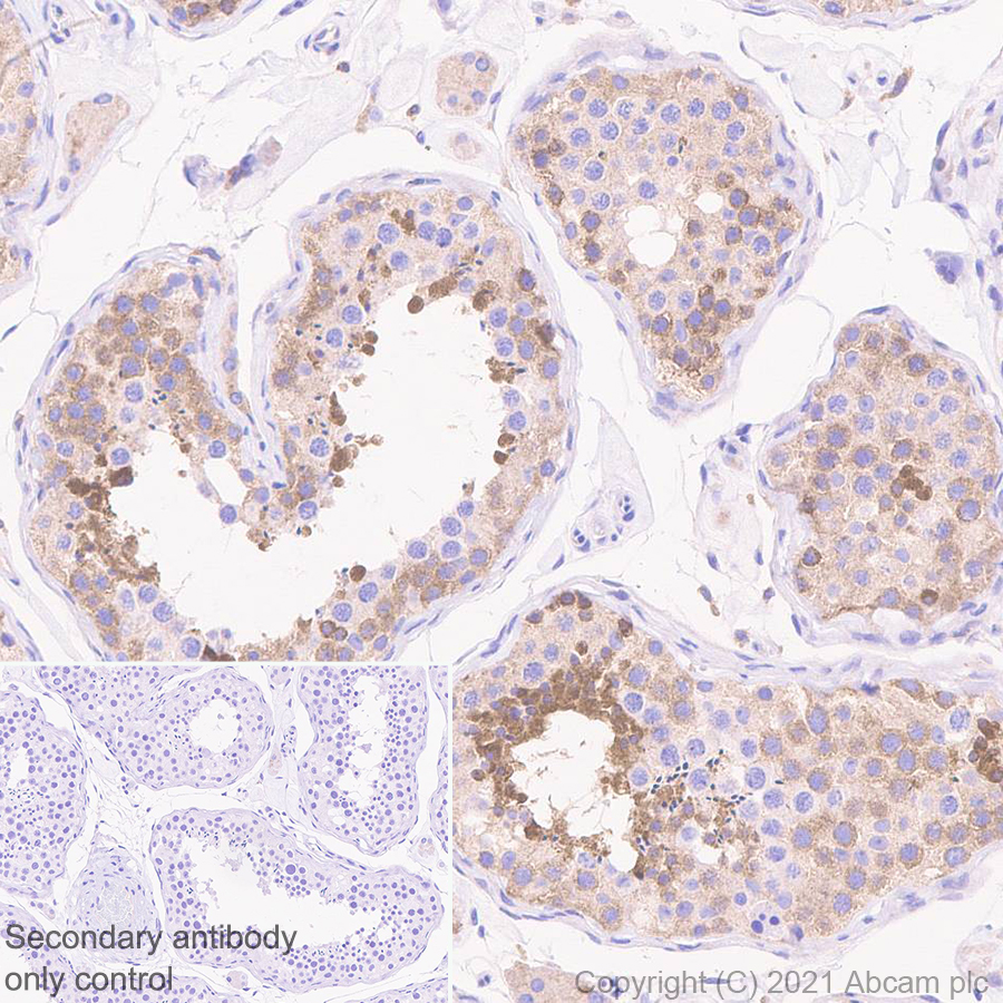 Immunohistochemistry (Formalin/PFA-fixed paraffin-embedded sections) - Anti-Dicer antibody [EPR24104-105] - BSA and Azide free (AB280957), expandable thumbnail