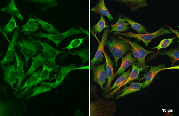 Immunocytochemistry/ Immunofluorescence - Anti-Dicer antibody [HL1232] (AB308349), expandable thumbnail