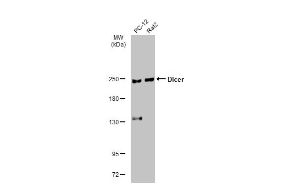 Western blot - Anti-Dicer antibody [HL1232] (AB308349), expandable thumbnail