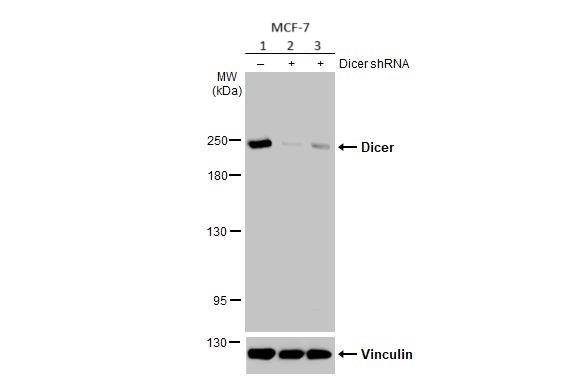Western blot - Anti-Dicer antibody [HL1232] (AB308349), expandable thumbnail
