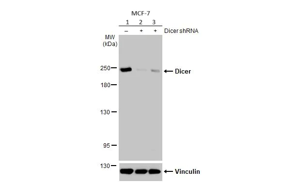 Western blot - Anti-Dicer antibody [HL1232] (AB308349)