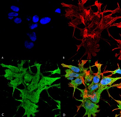 Immunocytochemistry/ Immunofluorescence - Anti-Dicer antibody [N167/7] (AB167444)