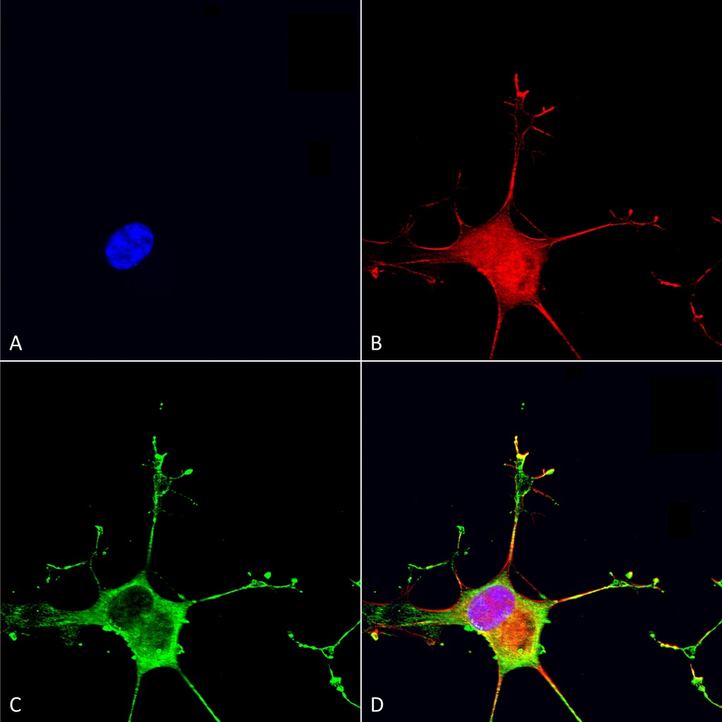 Immunocytochemistry/ Immunofluorescence - Anti-Dicer antibody [N167/7] (AB167444)