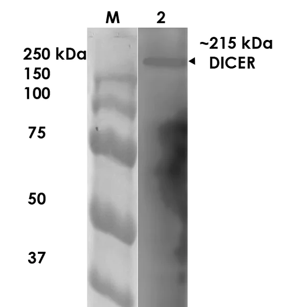 Western blot - Anti-Dicer antibody [N167/7] (AB167444)