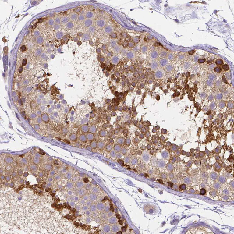 Immunohistochemistry (Formalin/PFA-fixed paraffin-embedded sections) - Anti-DICER1 Antibody [CL0378] (AB327103)