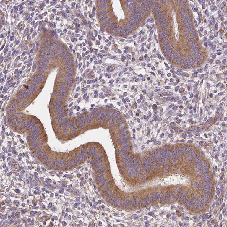 Immunohistochemistry (Formalin/PFA-fixed paraffin-embedded sections) - Anti-DICER1 Antibody [CL0378] (AB327103)