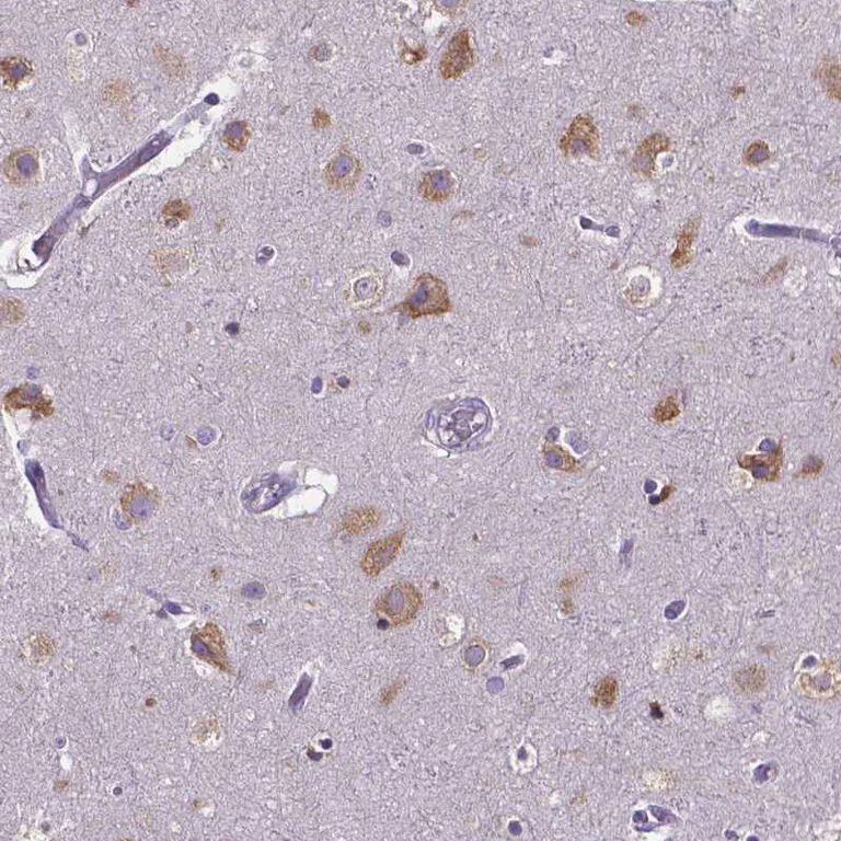 Immunohistochemistry (Formalin/PFA-fixed paraffin-embedded sections) - Anti-DICER1 Antibody [CL0378] (AB327103)