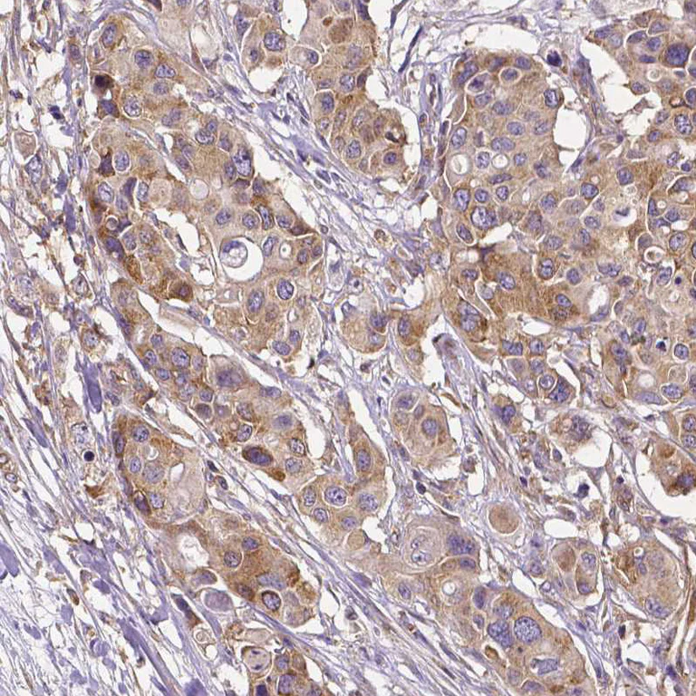 Immunohistochemistry (Formalin/PFA-fixed paraffin-embedded sections) - Anti-DICER1 Antibody [CL0378] (AB327103)
