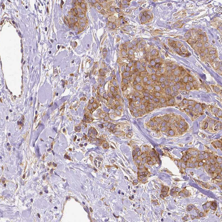 Immunohistochemistry (Formalin/PFA-fixed paraffin-embedded sections) - Anti-DICER1 Antibody [CL0378] (AB327103)