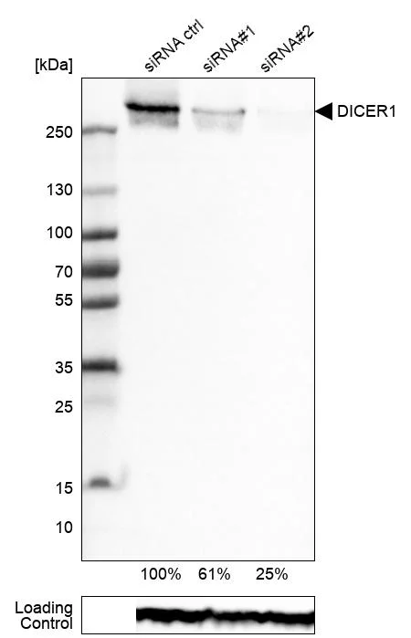 Western blot - Anti-DICER1 Antibody [CL0378] (AB327103)