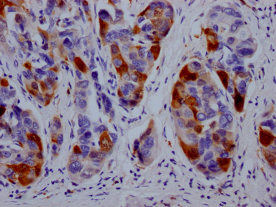 Immunohistochemistry (Formalin/PFA-fixed paraffin-embedded sections) - Anti-Dihydrofolate reductase (DHFR) antibody [9B2] (AB288373), expandable thumbnail