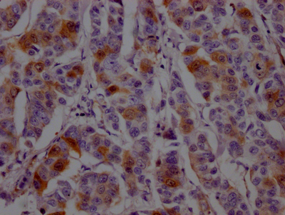 Immunohistochemistry (Formalin/PFA-fixed paraffin-embedded sections) - Anti-Dihydrofolate reductase (DHFR) antibody [9B2] (AB288373), expandable thumbnail