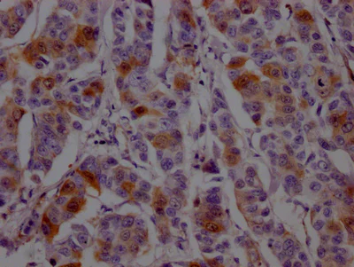 Immunohistochemistry (Formalin/PFA-fixed paraffin-embedded sections) - Anti-Dihydrofolate reductase (DHFR) antibody [9B2] (AB288373)