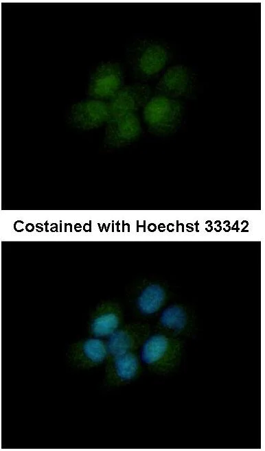 Immunocytochemistry/ Immunofluorescence - Anti-Dihydrofolate reductase (DHFR) antibody (AB152159)