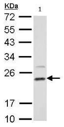 Western blot - Anti-Dihydrofolate reductase (DHFR) antibody (AB152159)