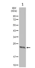 Western blot - Anti-Dihydrofolate reductase (DHFR) antibody (AB152159)