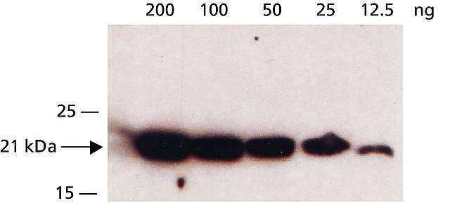Western blot - Anti-Dihydrofolate reductase (DHFR) antibody (AB49881)