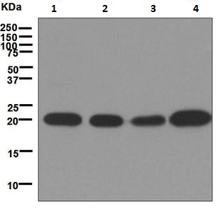 Western blot - Anti-Dihydrofolate reductase (DHFR) antibody [EPR5284] (AB133546), expandable thumbnail