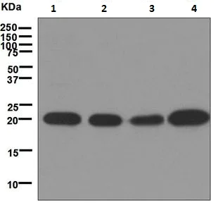 Western blot - Anti-Dihydrofolate reductase (DHFR) antibody [EPR5284] (AB133546)