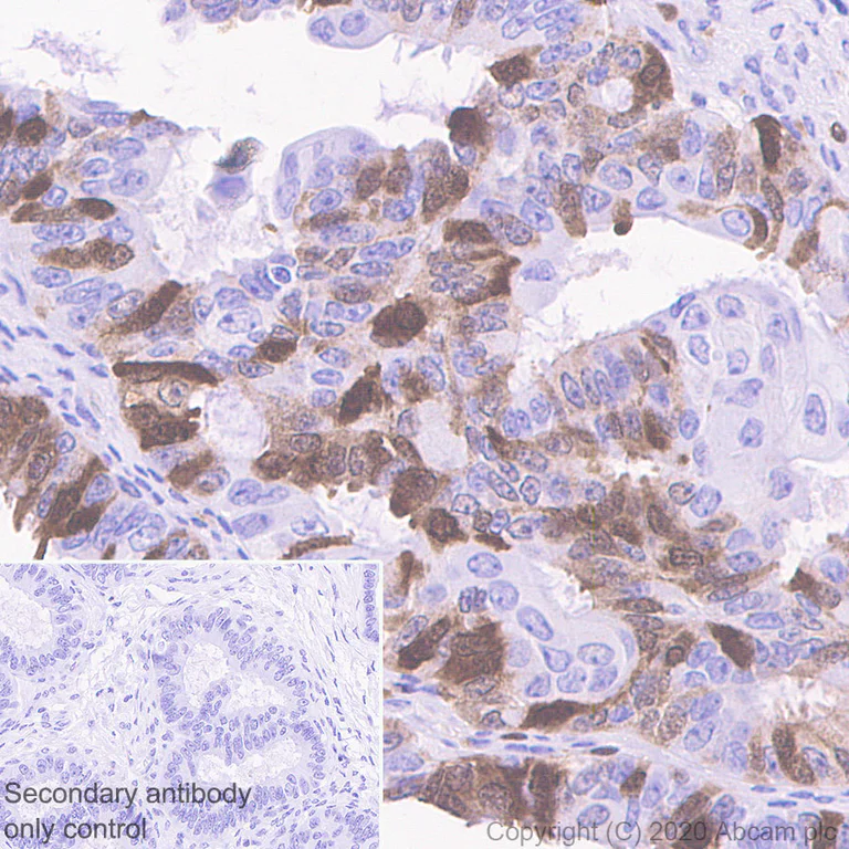 Immunohistochemistry (Formalin/PFA-fixed paraffin-embedded sections) - Anti-Dihydrofolate reductase (DHFR) antibody [EPR5285] (AB124814)