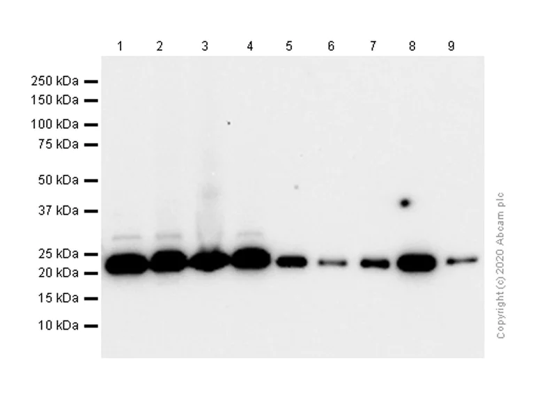 Western blot - Anti-Dihydrofolate reductase (DHFR) antibody [EPR5285] - BSA and Azide free (AB248017)