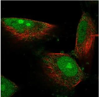 Immunocytochemistry - Anti-DIMT1L antibody (AB184978)