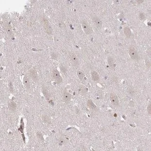Immunohistochemistry (Formalin/PFA-fixed paraffin-embedded sections) - Anti-DIMT1L antibody (AB184978)