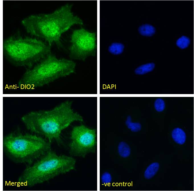 Anti-DIO2 antibody