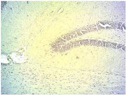 Immunohistochemistry (Frozen sections) - Anti-DIO2 antibody (AB77481)