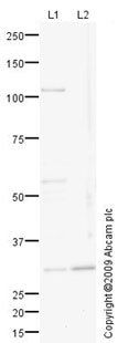 Western blot - Anti-DIO2 antibody (AB77779)