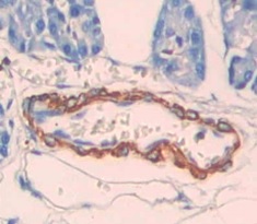 Immunohistochemistry (Formalin/PFA-fixed paraffin-embedded sections) - Anti-Dio3 antibody (AB233035), expandable thumbnail